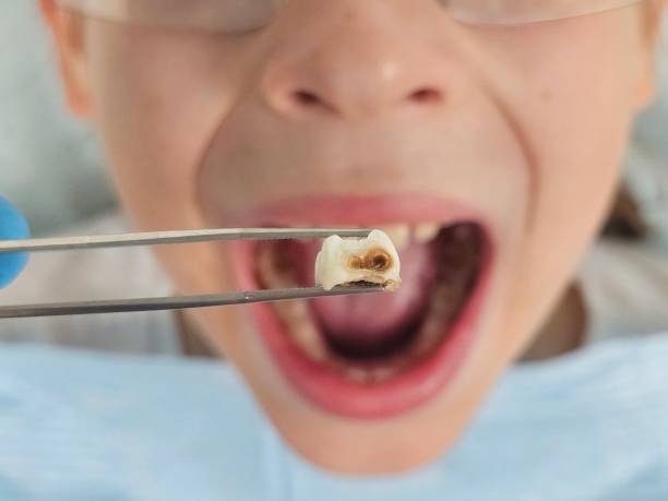 Best Emergency Pediatric Dentist  in Crystal Springs, MS